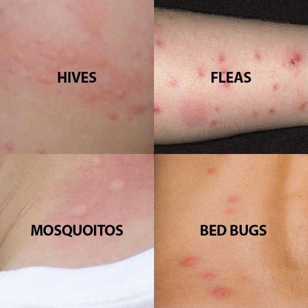 Comparison Bed Bugs from others