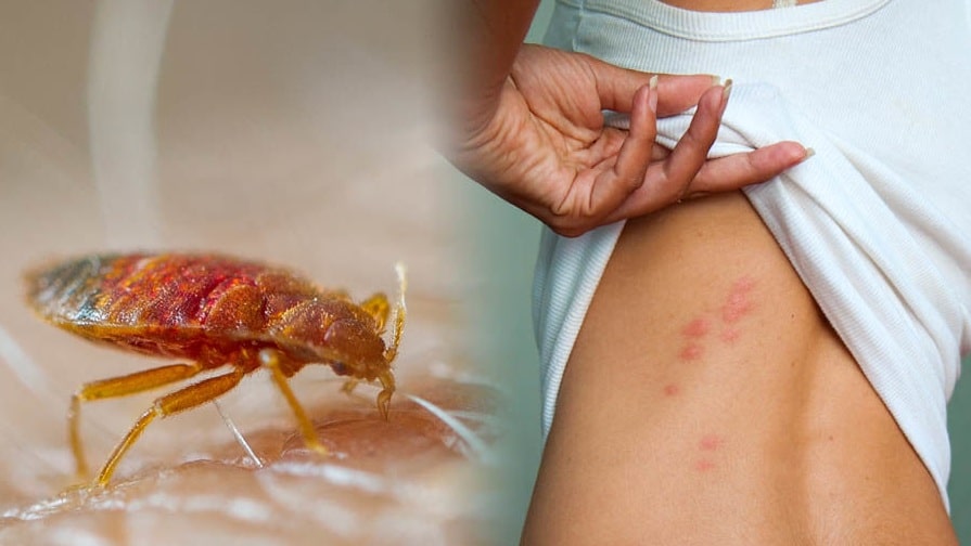 bed bugs and how to get rid of them