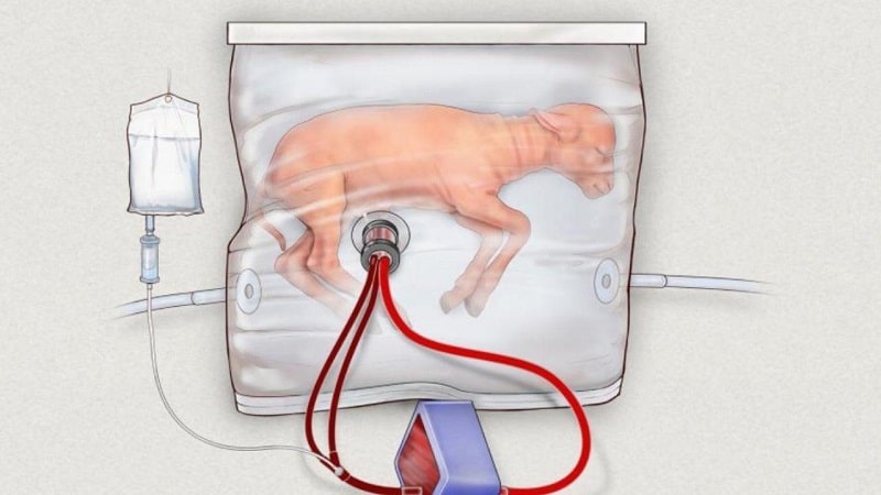 Artificial Womb Successfully Gestates Baby Sheep