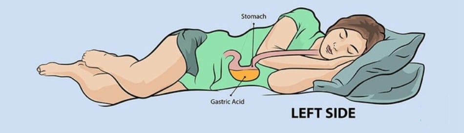 Left side sleep gastric juice