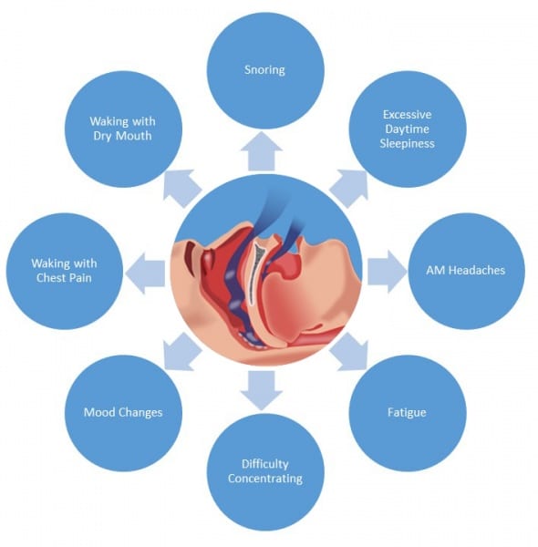 Symptoms of Obstructive Sleep Apnea