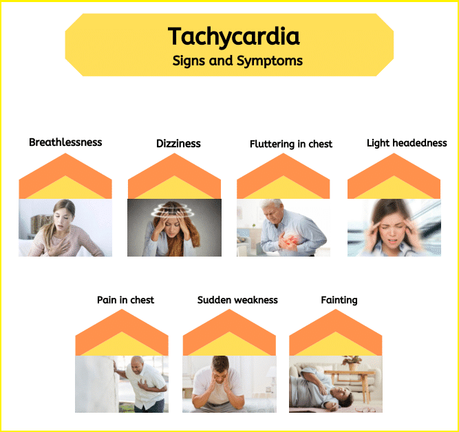 Tachycardia Symptoms