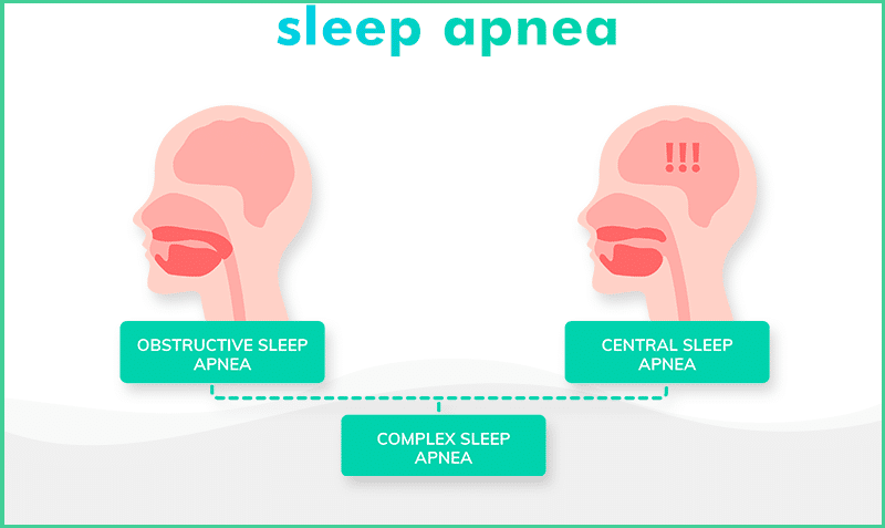Three types of sleep apnea