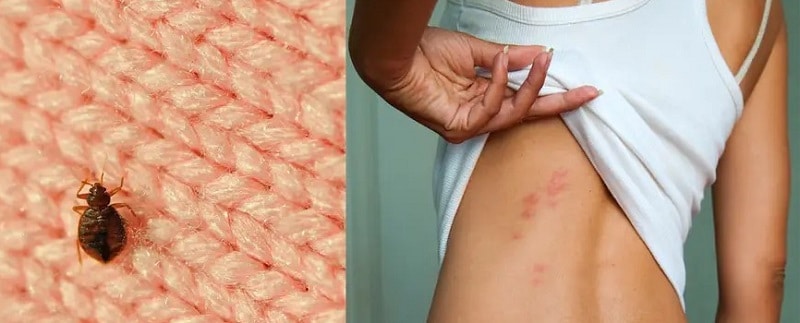 bed bugs cause skin conditions